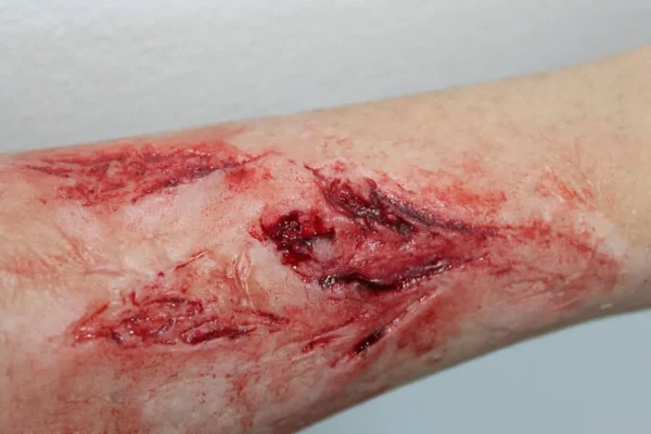 ForensicFX Studios Arm Lacerations/Cuts Prosthetic> Halloween Accessories