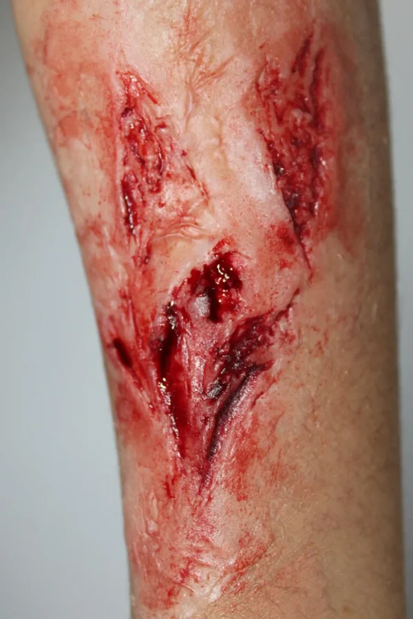 ForensicFX Studios Arm Lacerations/Cuts Prosthetic> Halloween Accessories