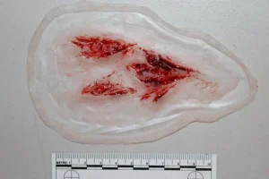 ForensicFX Studios Arm Lacerations/Cuts Prosthetic> Halloween Accessories