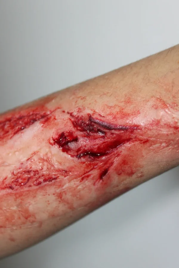 ForensicFX Studios Arm Lacerations/Cuts Prosthetic> Halloween Accessories