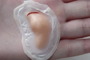 ForensicFX Studios Bruised Broken Nose With Cut Prosthetic> Halloween Accessories