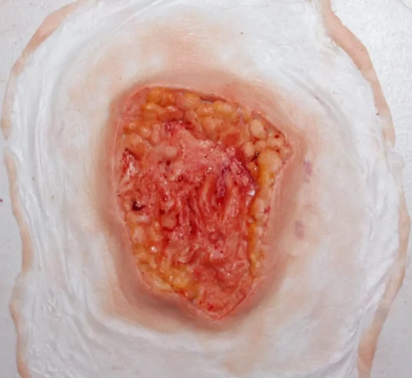 ForensicFX Studios Deep Fatty Tissue Wound Prosthetic> Halloween Accessories