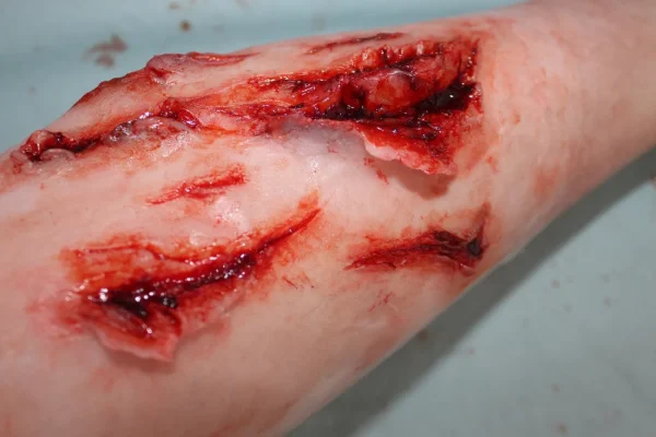 ForensicFX Studios Deep Leg Lacerations Prosthetic> Halloween Accessories