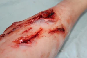 ForensicFX Studios Deep Leg Lacerations Prosthetic> Halloween Accessories