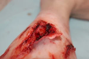 ForensicFX Studios Deep Leg Lacerations Prosthetic> Halloween Accessories