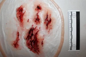 ForensicFX Studios Deep Leg Lacerations Prosthetic> Halloween Accessories
