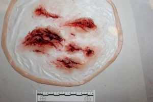 ForensicFX Studios Deep Leg Lacerations Prosthetic> Halloween Accessories