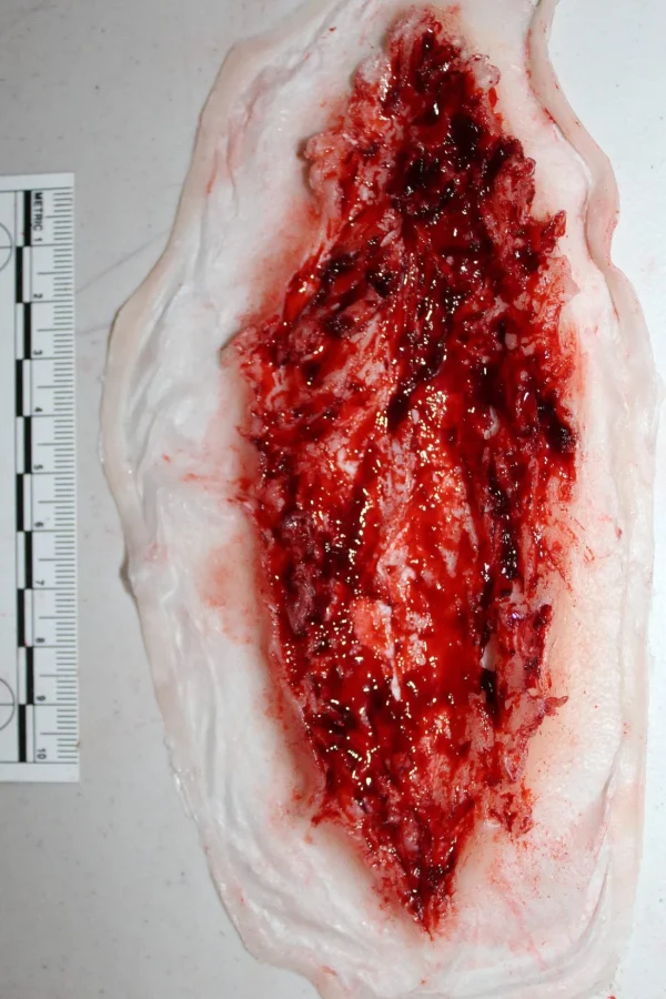 ForensicFX Studios Deep Slashed Trauma Wound Prosthetic> Halloween Accessories