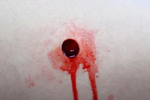 ForensicFX Studios Entry & Exit Bullet Wound Prosthetic> Halloween Accessories