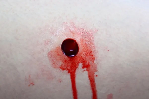 ForensicFX Studios Entry & Exit Bullet Wound Prosthetic> Halloween Accessories
