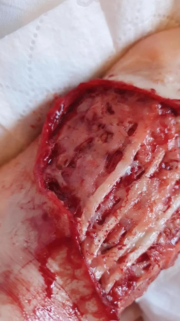 ForensicFX Studios Exposed Foot Ligaments Prosthetic> Halloween Accessories
