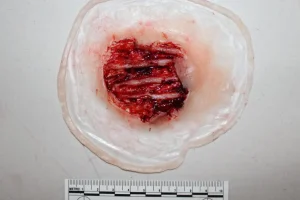 ForensicFX Studios Exposed Hand Ligaments Prosthetic> Halloween Accessories