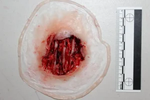 ForensicFX Studios Exposed Hand Ligaments Prosthetic> Halloween Accessories