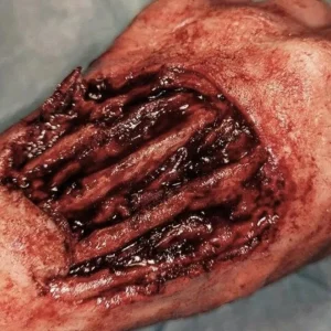 ForensicFX Studios Gorey Prosthetics Bundle> Halloween Accessories