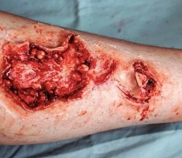 ForensicFX Studios Gorey Prosthetics Bundle> Halloween Accessories