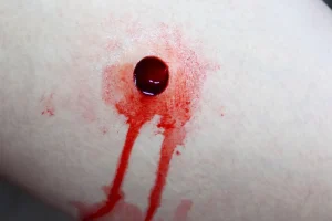 ForensicFX Studios Gunshot Entry Bullet Wound Prosthetic> Halloween Accessories