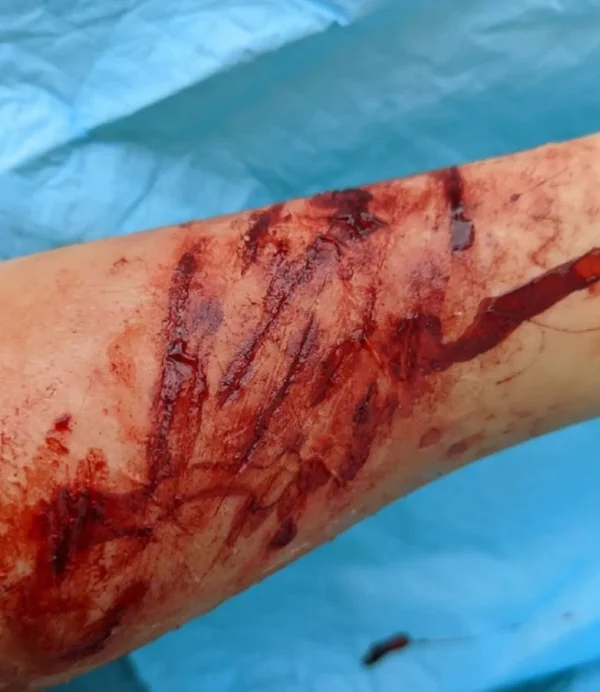 ForensicFX Studios Knife/Stab Wound Prosthetic Bundle> Halloween Accessories