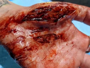 ForensicFX Studios Knife/Stab Wound Prosthetic Bundle> Halloween Accessories
