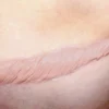 ForensicFX Studios Large Healed Keloid Scar> Halloween Accessories