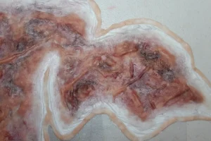 ForensicFX Studios Large Torso Skin Burn Prosthetic> Halloween Accessories