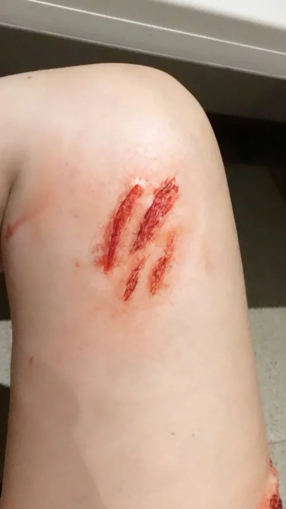 ForensicFX Studios Medium Scratch Mark Wounds Prosthetic> Halloween Accessories