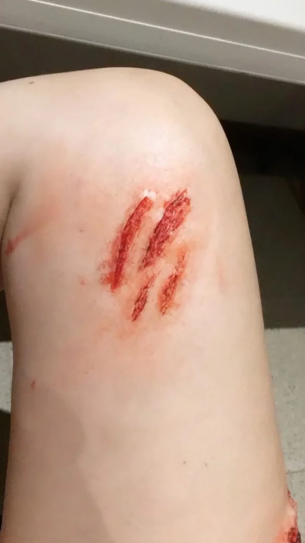 ForensicFX Studios Medium Scratch Mark Wounds Prosthetic> Halloween Accessories