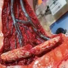 ForensicFX Studios Open Collarbone Wound Prosthetic> Halloween Accessories