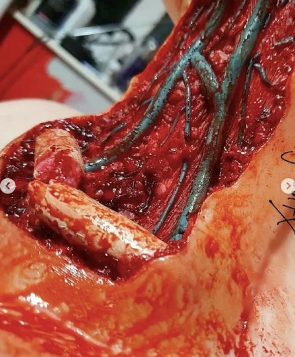 ForensicFX Studios Open Collarbone Wound Prosthetic> Halloween Accessories