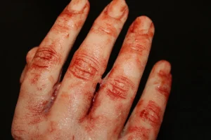 ForensicFX Studios Severed Half-Hand Prop> Halloween Accessories