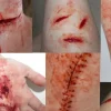 ForensicFX Studios Simple Prosthetics Bundle> Halloween Accessories