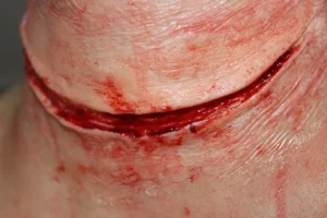 ForensicFX Studios Simple Slit Throat Prosthetic> Halloween Accessories