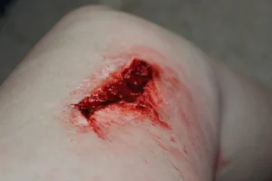 ForensicFX Studios Simple Wound Prosthetic> Halloween Accessories