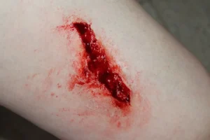 ForensicFX Studios Simple Wound Prosthetic> Halloween Accessories