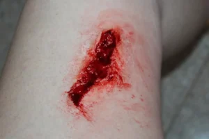 ForensicFX Studios Simple Wound Prosthetic> Halloween Accessories