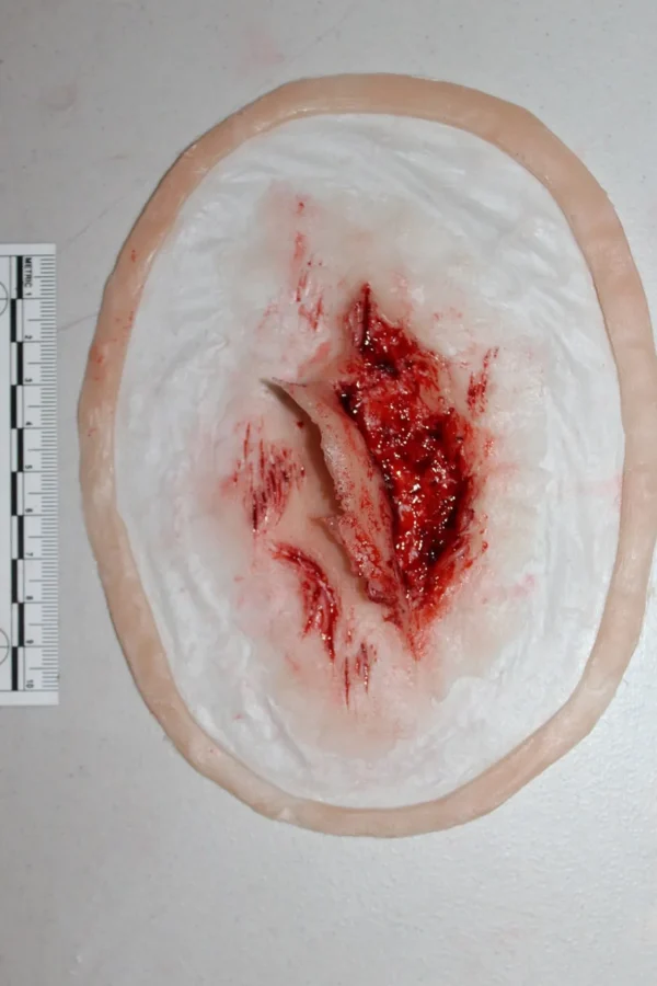 ForensicFX Studios Skin Peeling Back Wound Prosthetic> Halloween Accessories