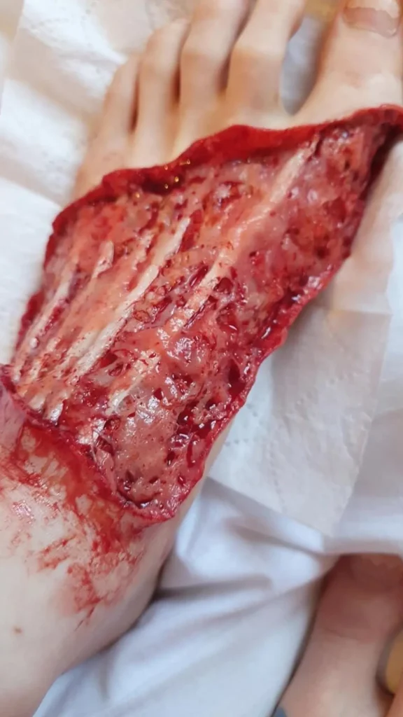 ForensicFX Studios Skinned Alive Prosthetic Bundle> Halloween Accessories