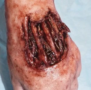 ForensicFX Studios Skinned Alive Prosthetic Bundle> Halloween Accessories