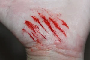 ForensicFX Studios Small Shallow Cuts Prosthetic> Halloween Accessories