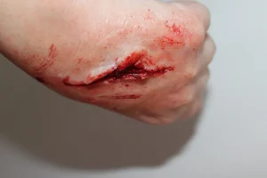 ForensicFX Studios Small Shallow Laceration Prosthetic> Halloween Accessories