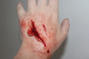 ForensicFX Studios Small Shallow Laceration Prosthetic> Halloween Accessories