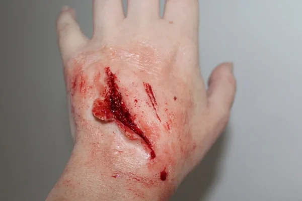 ForensicFX Studios Small Shallow Laceration Prosthetic> Halloween Accessories