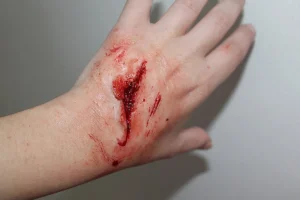 ForensicFX Studios Small Shallow Laceration Prosthetic> Halloween Accessories
