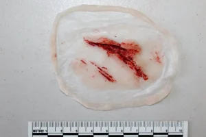 ForensicFX Studios Small Shallow Laceration Prosthetic> Halloween Accessories