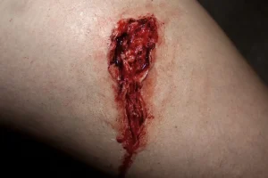 ForensicFX Studios Small Thigh Laceration Prosthetic> Halloween Accessories