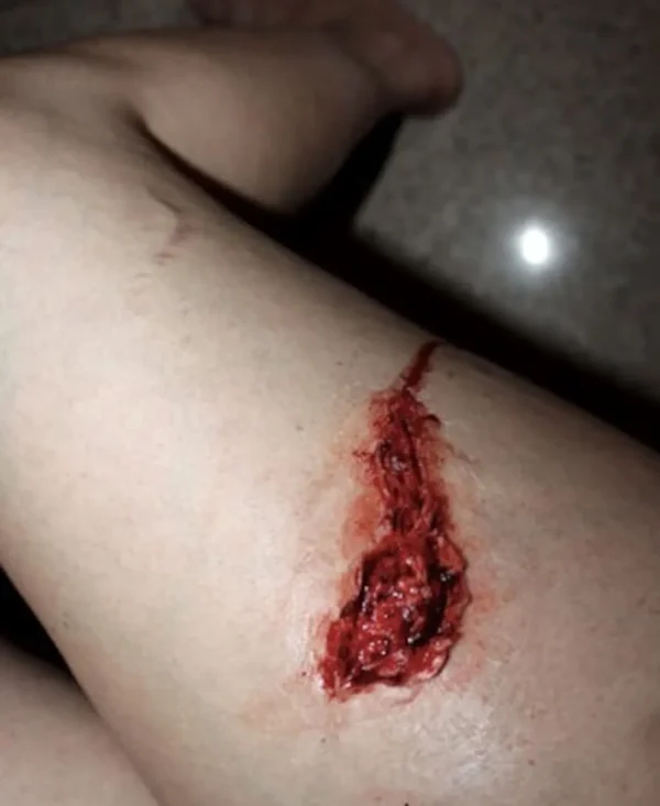 ForensicFX Studios Small Thigh Laceration Prosthetic> Halloween Accessories