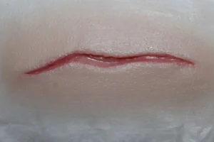 ForensicFX Studios Small Thin Scar Wound Prosthetic> Halloween Accessories