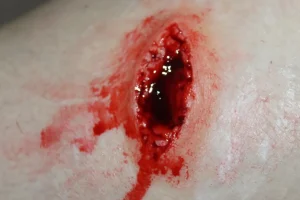 ForensicFX Studios Stab Wound Prosthetic> Halloween Accessories