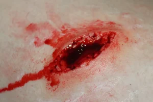 ForensicFX Studios Stab Wound Prosthetic> Halloween Accessories