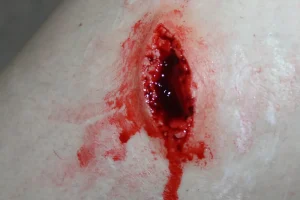 ForensicFX Studios Stab Wound Prosthetic> Halloween Accessories