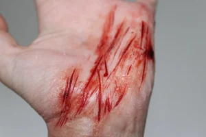 ForensicFX Studios Thin Cuts Prosthetic Bundle> Halloween Accessories
